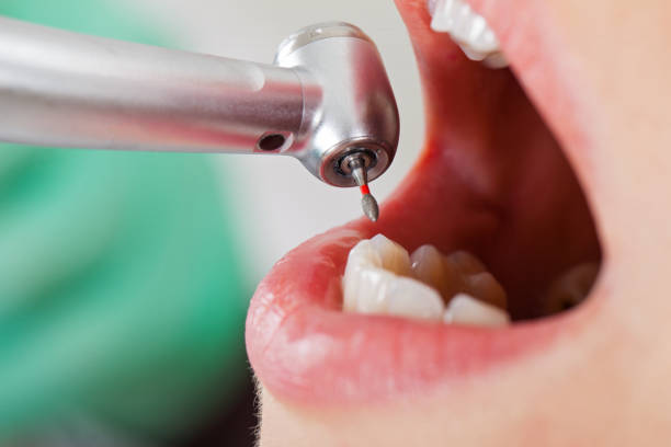 Best Emergency Dental Care for Broken or Chipped Teeth in Mickleton, NJ